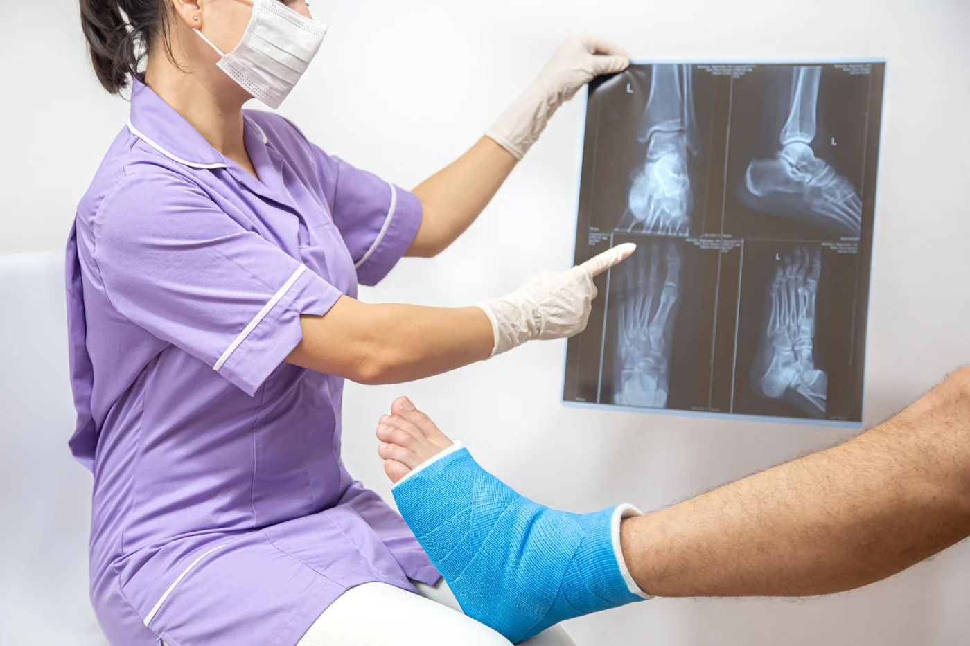 Clinician explaining foot X-rays to a patient with a leg cast