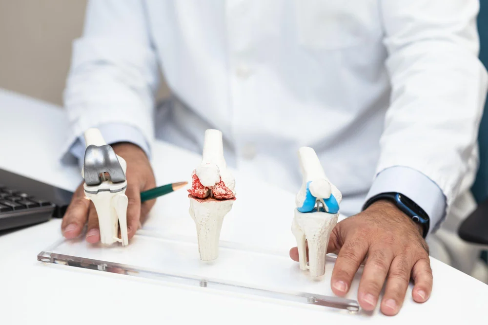 Joint Replacement
