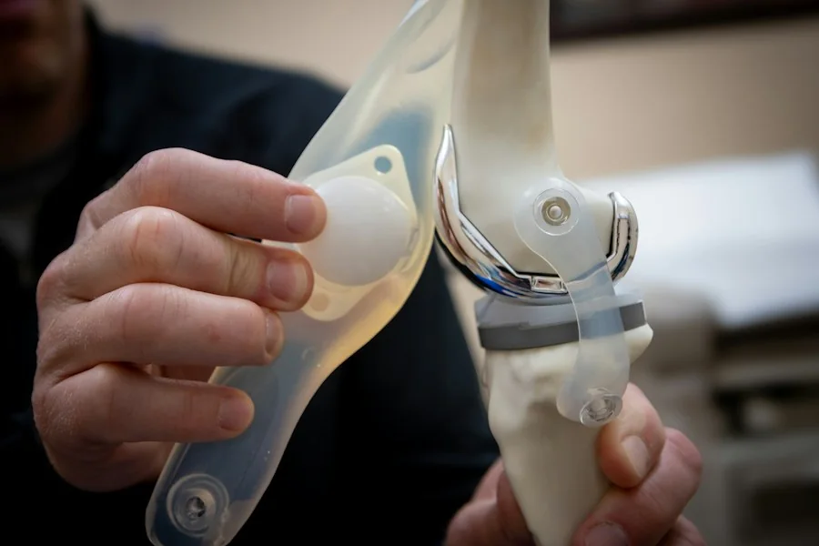 Knee Replacement